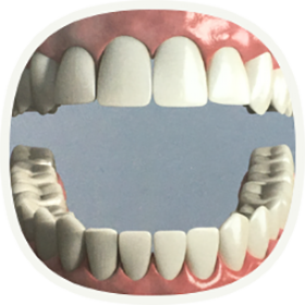 Implantat bei einem fehlenden Zahn